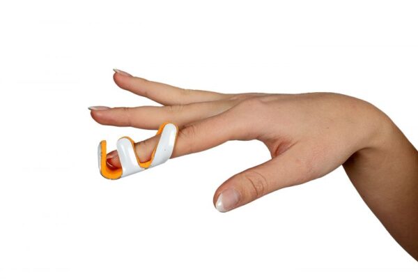 FROG SPLINT - Image 2