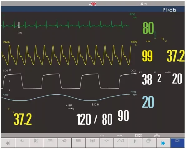 Macs 50 Modular patient monitor - Image 2