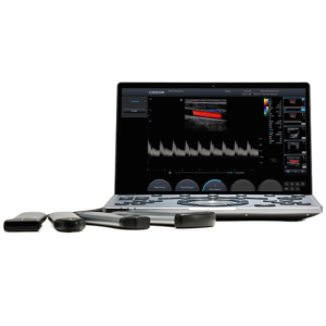 SonoAir 60